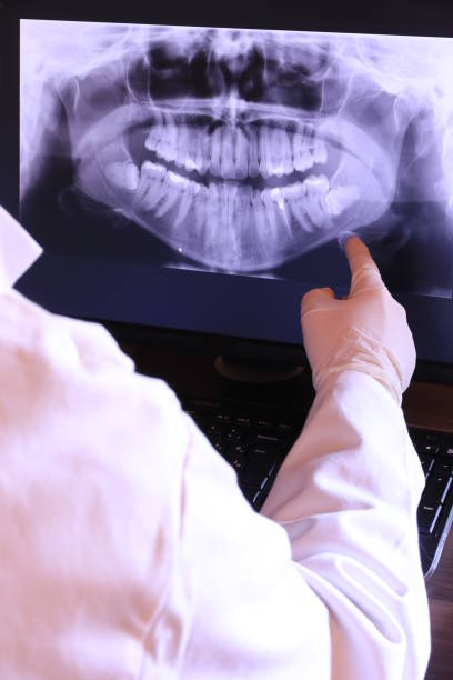 Best Emergency Dental Care for Broken or Chipped Teeth in St Paul Park, MN
